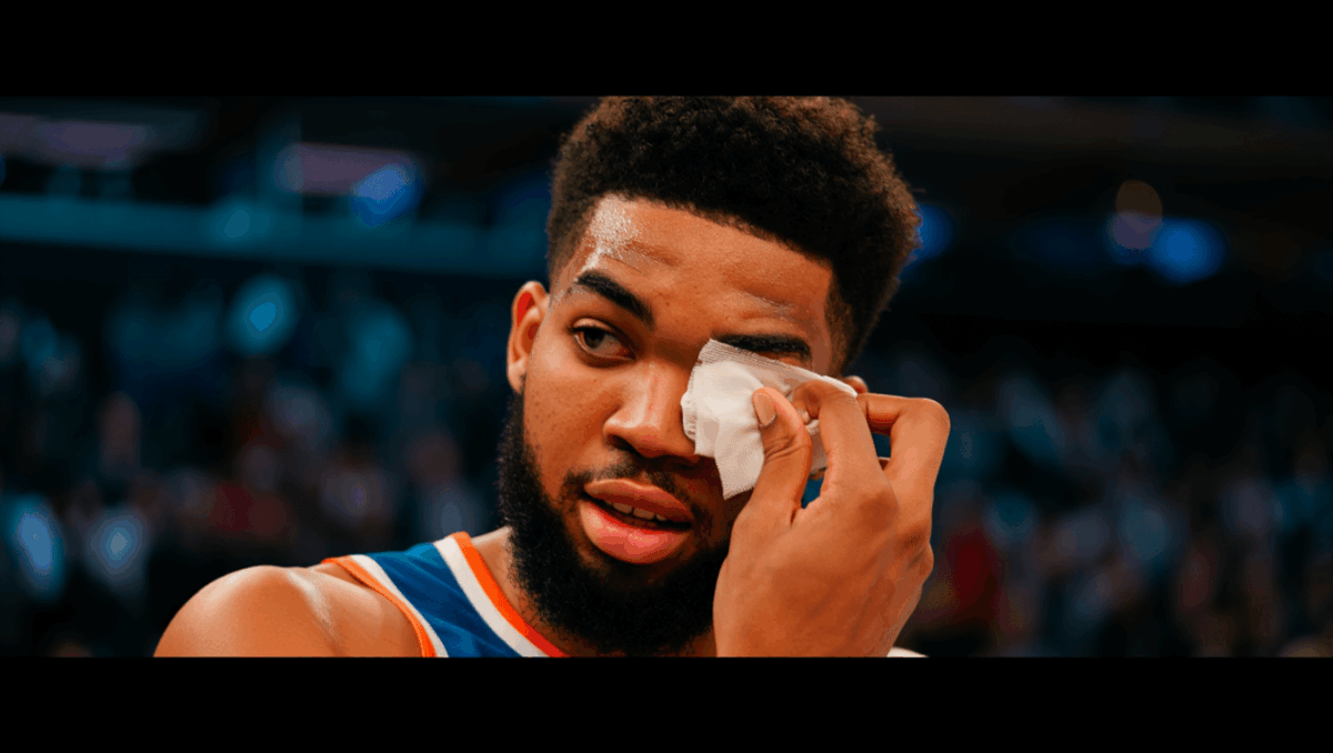 Karl Anthony Towns suffers cut over right eye after collision with Spencer Jones